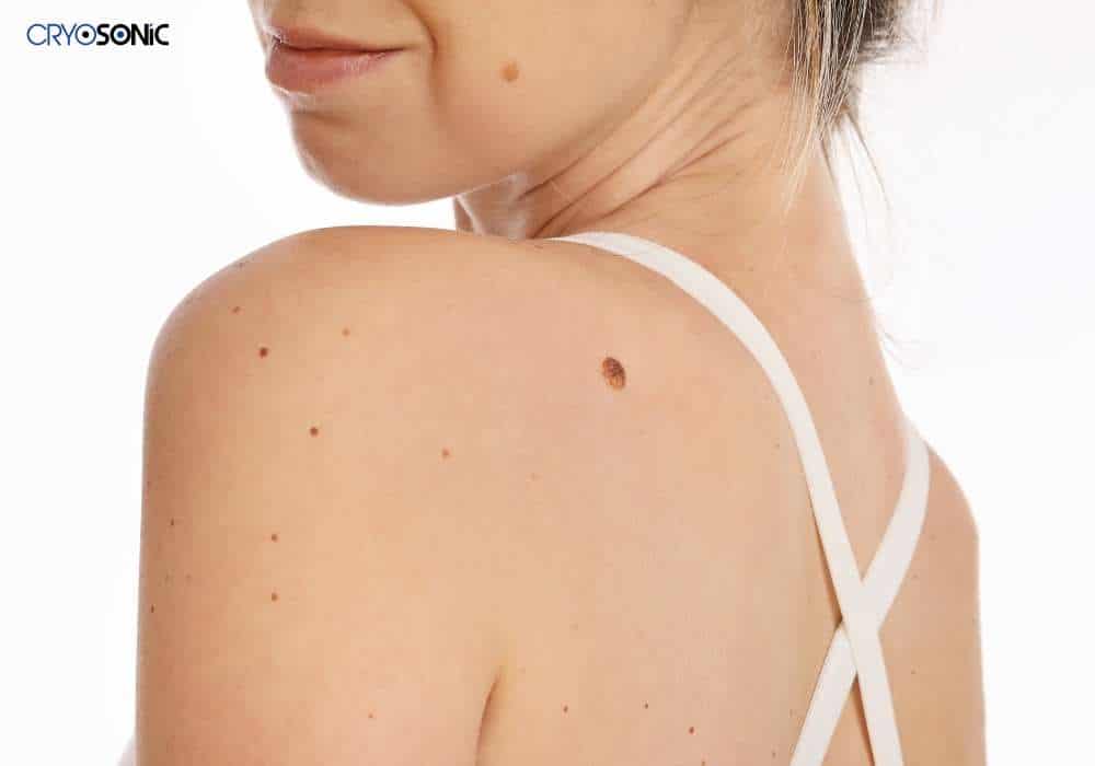 What Takes Place If the Healing Process Takes Longer Than 30 Days Featherstone