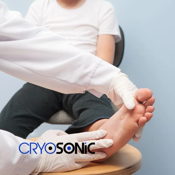 Are you looking for fast effective wart removal Contact us today Featherstone