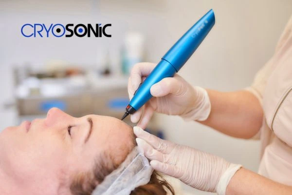 Treatment Timeline: What to Expect After Removal of a Wart or Skin Tag – Day 1 to Day 30 Featherstone
